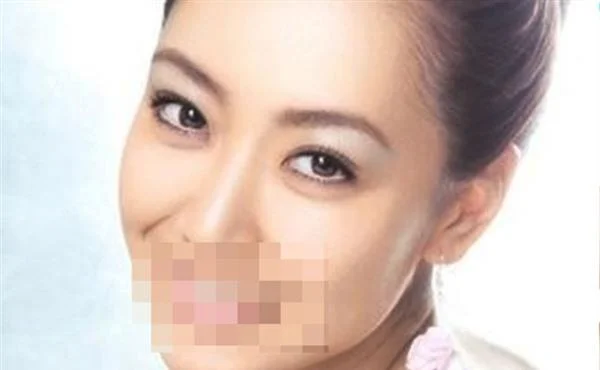 彩光嫩肤需要多少钱？