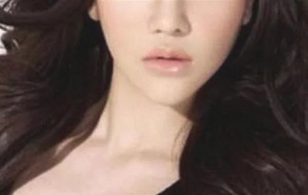 冷冻法去黄褐斑价格多少钱