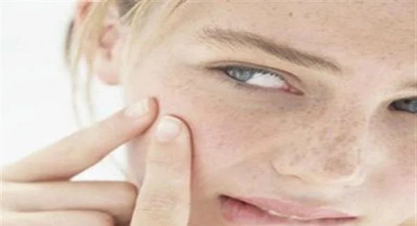 手术瘢痕疙瘩怎么去