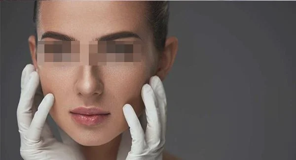 剥脱治疗去雀斑费用