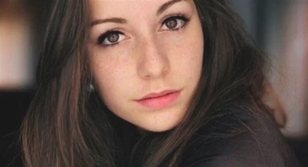 法令纹填充如何消除法令纹