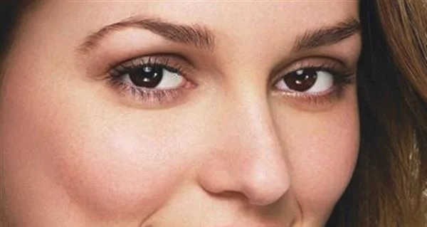 去黄褐斑的简单方法