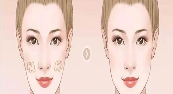 点痣留下的疤该怎么祛除