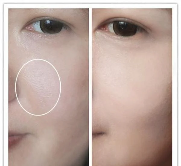 如何缩小脸部毛孔