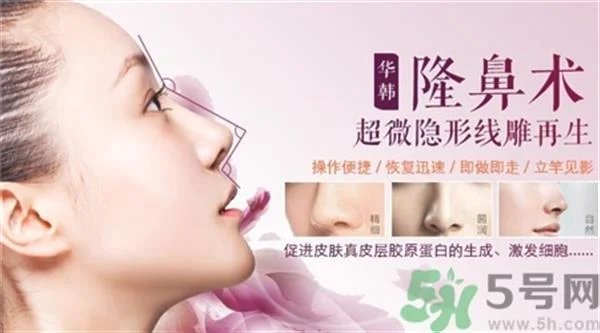 线雕隆鼻是什么?线雕隆鼻可以保持多久?